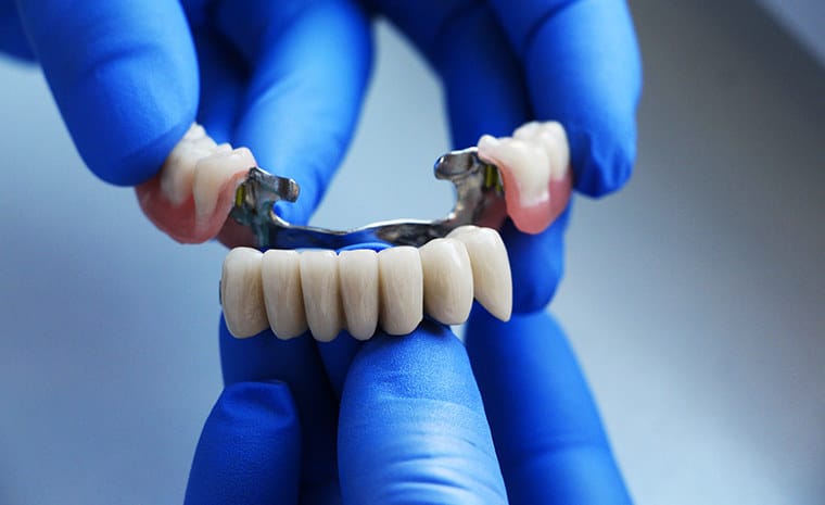 Dental Bridges tools in Anoka Dental