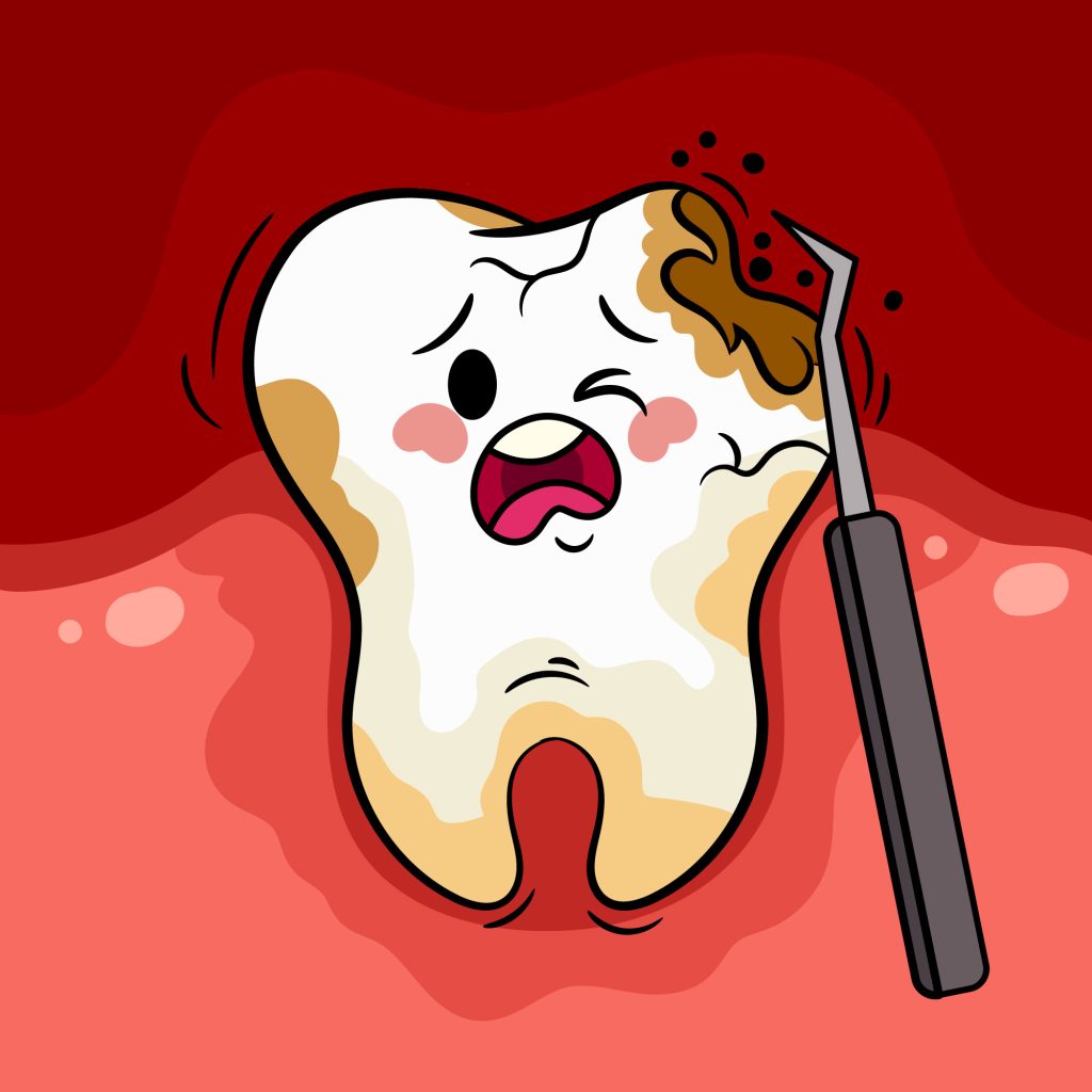 infected root canal treatment