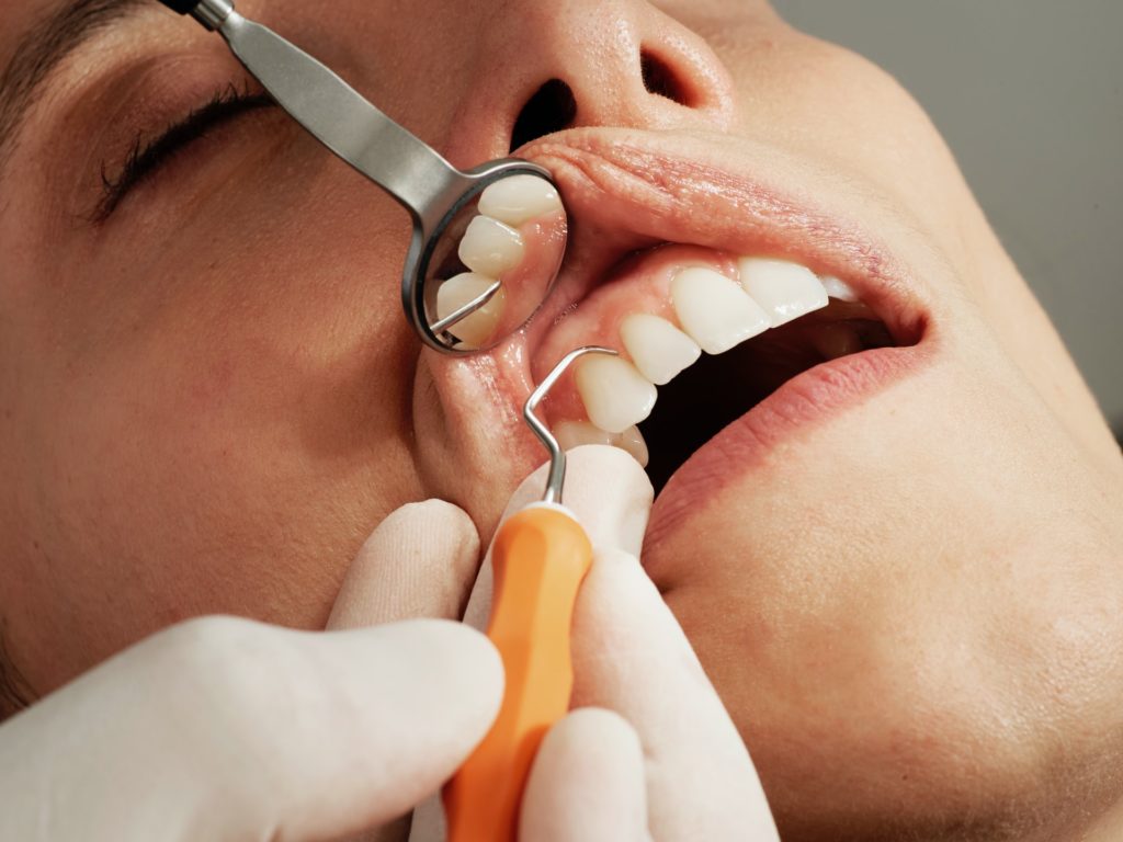 Dentist Checking Teeth with tool