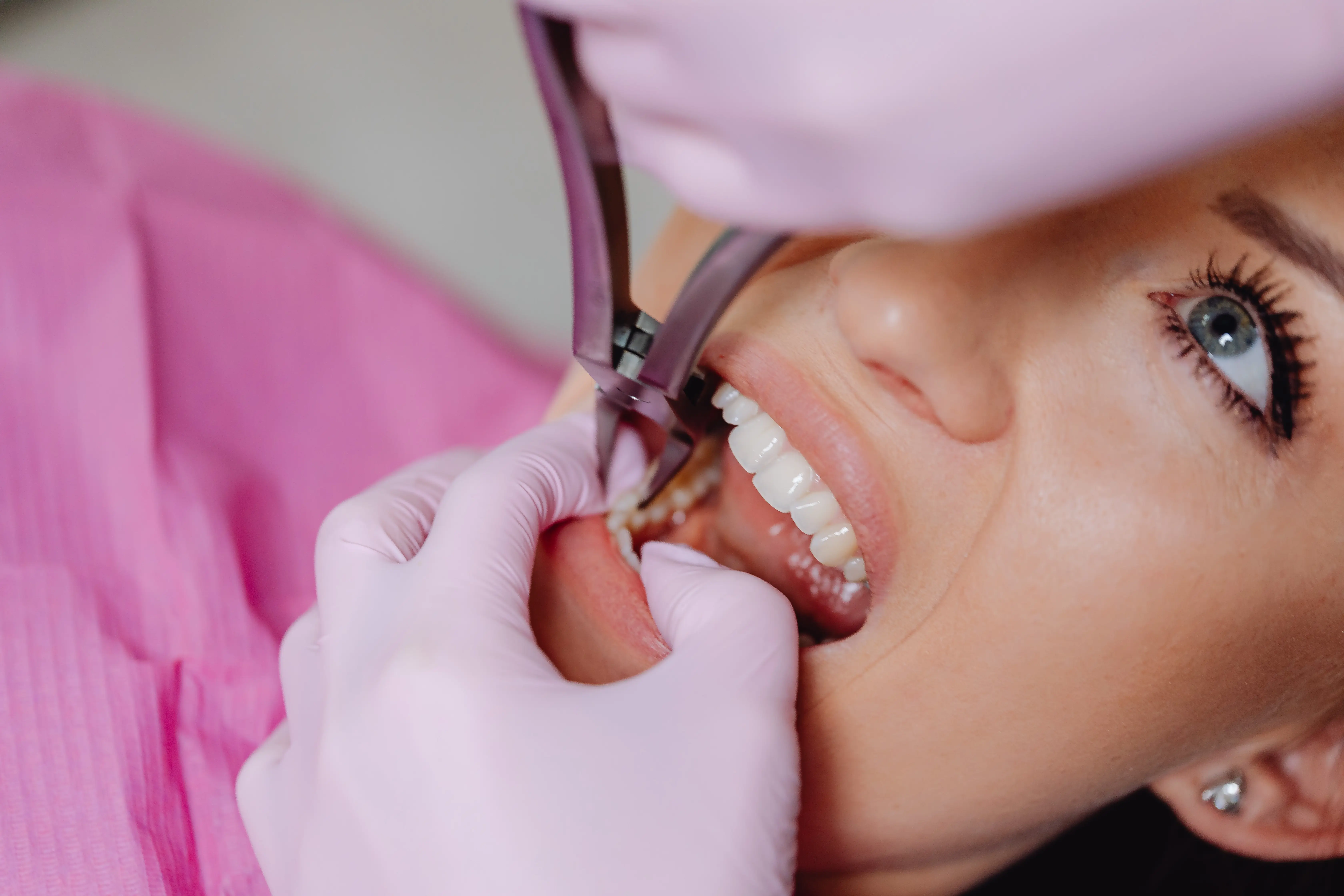 tooth extraction of young woman