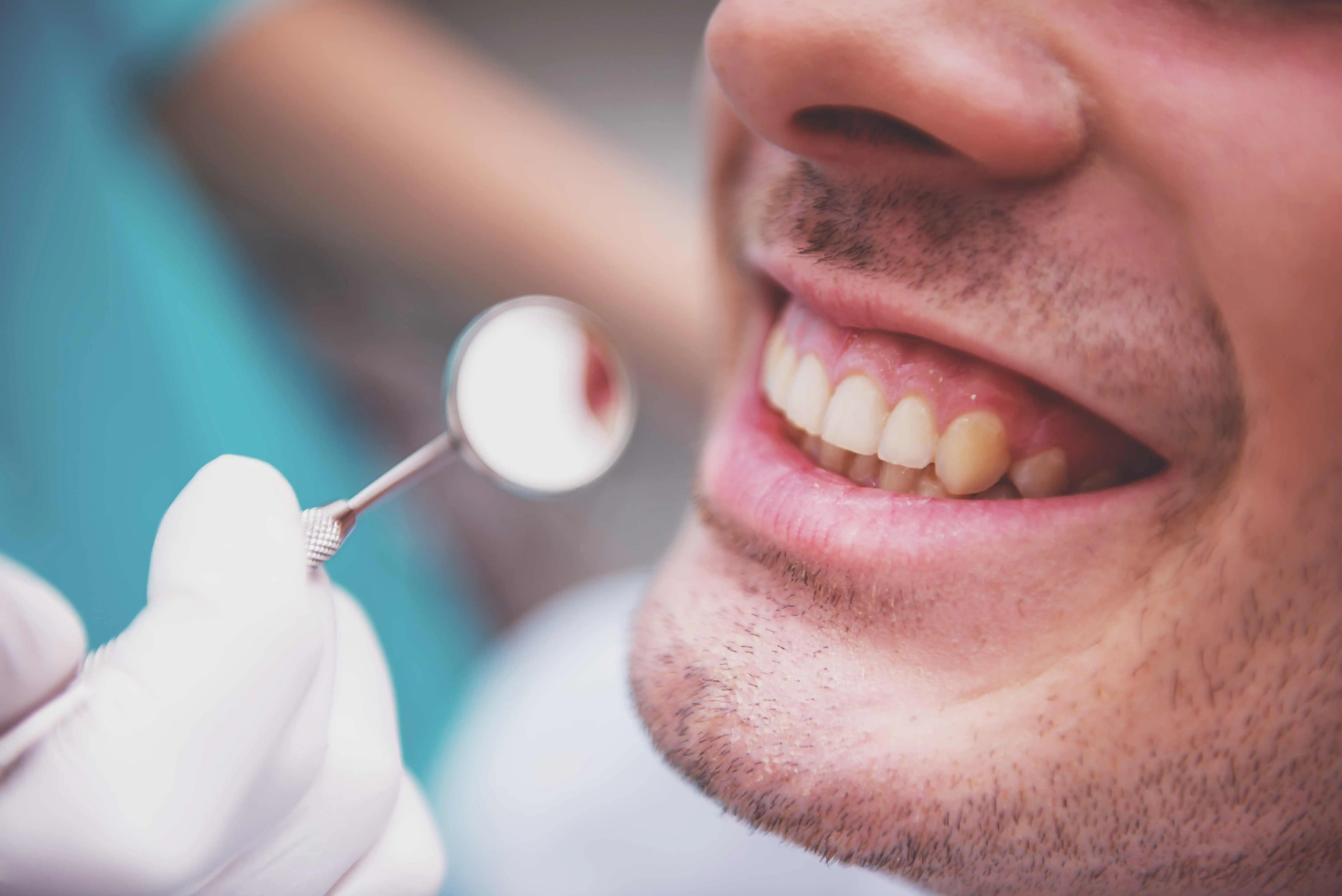 Teeth Stains: Causes, Types, and How to Remove Them