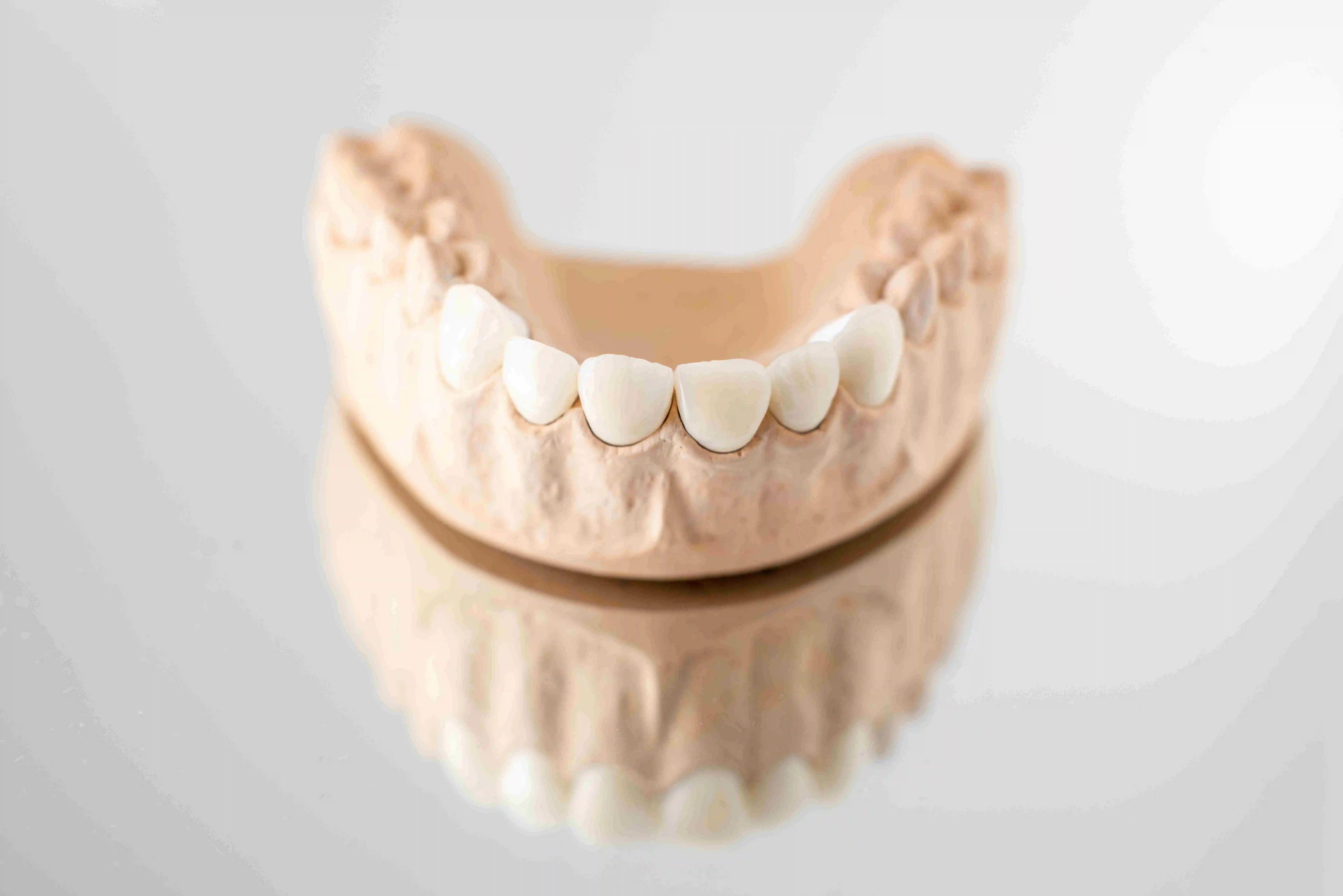 The Finest Alternatives to Dental Implants