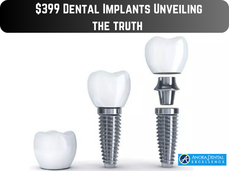 $399 Dental Implants Unveiling the truth