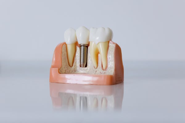 $399 dental implants near me