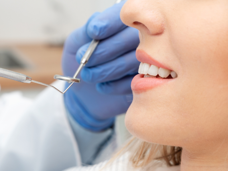 5 Reasons Why Preventive Dental Care is Important