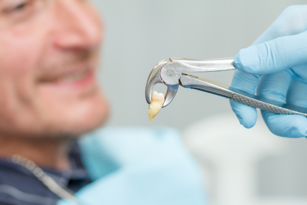 How to Prevent a Dry Socket After Tooth Extraction