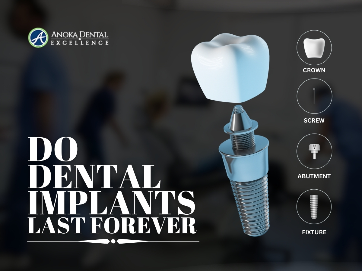 Do dental implants last for ever