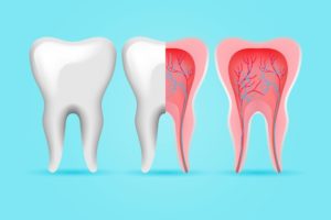 pros and cons of root canal