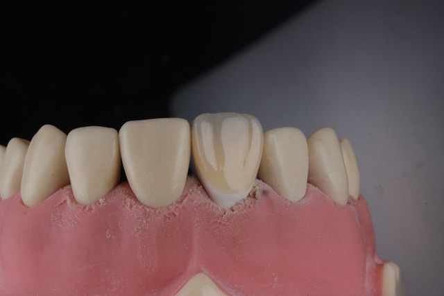 front tooth crown