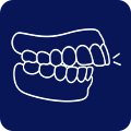 Overbite