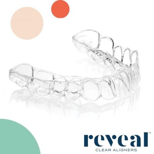 Reveal Teeth Aligners Anoka MN Reveal Teeth Aligners Anoka MN